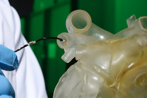 Des scientifiques de l’EPFL et de l’ETH Zürich ont développé un cathéter composé de fils non toxiques, permettant de passer d’un état souple à un état rigide pendant une intervention chirurgicale.