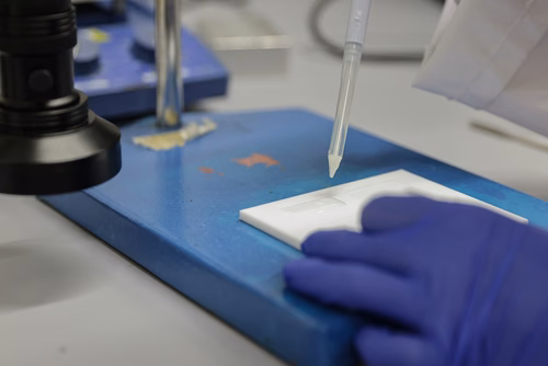 In collaboration with CHUV, EPFL engineers propose wrapping an adhesive hydrogel patch around a collapsed trachea for treatment of Tracheomalacia.