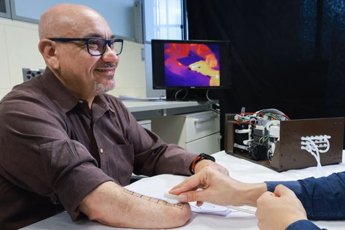 Une découverte inattendue, à propos des retours sensoriels thermiques, a donné naissance à une nouvelle technologie bionique. Elle permet aux personnes amputées d’éprouver la température des objets – chaud et froid – directement avec leur main fantôme. La technologie ouvre de nouvelles possibilités pour des prothèses non invasives.